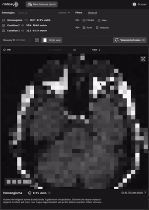 An animated prototype, showing the user clicking around the UI, expanding & collapsing sections, and navigating through the cases
